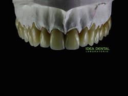 Horario de apertura Idea Dental, Huércal de Almería