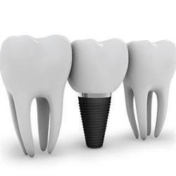 Horario de apertura Clínica Dental Sonrisol, Torremolinos