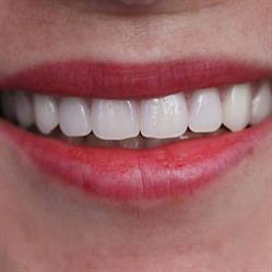 Clínica Dental Torrefiel en Valencia (Rascanya) - Horario de apertura