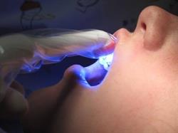 Horario de apertura Clínica DentalArtés, Palamós