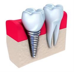 Horario de apertura Clínica dental El Puente, Ourense