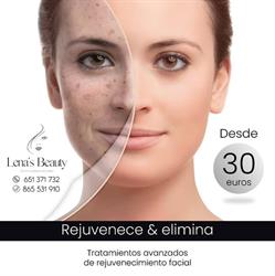 Horario de apertura Lenas Beauty Centro Estética & Láser, Alicante