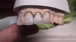 Horario de apertura Salvador Piña - Diseño Dental, Narón
