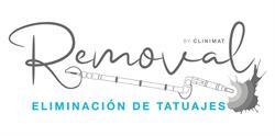 Horario de apertura Removal eliminación de tatuajes Mataró,