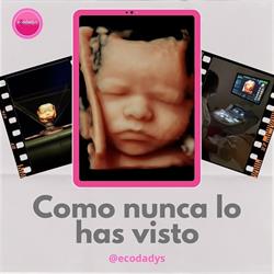 Horario de apertura Ecodadys Barcelona. Especialistas en ecografias 5D-4D,